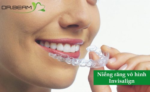 5 lý do chọn niềng răng trong suốt invisalign
