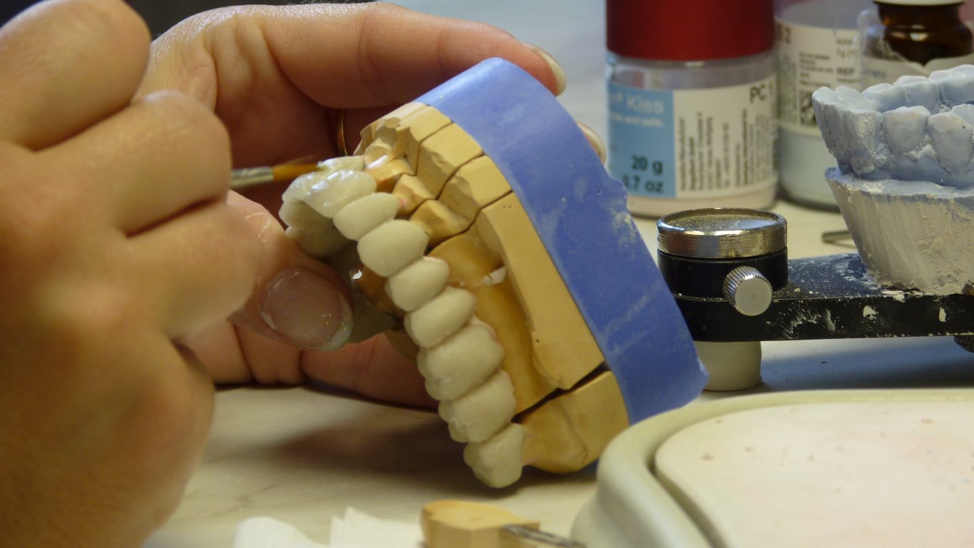 bọc răng sứ mất bao lâu - Ceramic Crown - Nha khoa Quốc tế DND