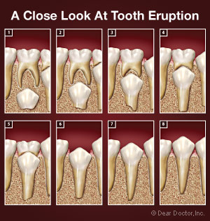 Quá trình thay răng sữa bằng răng vĩnh viễn