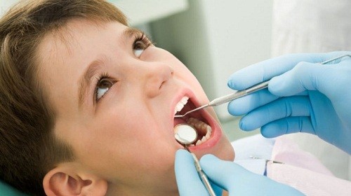 Điều trị tủy răng ở trẻ em hiện nay được thực hiện khá dễ dàng và có thể dự đoán được