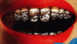Hút thuốc lá có hại cho răng