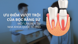 Ưu điểm của bọc răng sứ 1 lần hẹn tại Nha khoa quốc tế DND