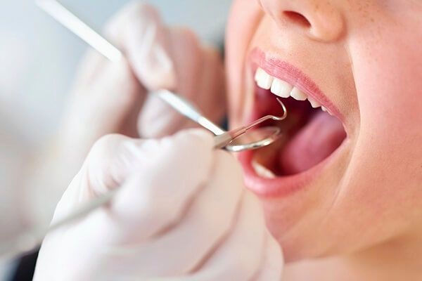 nhổ răng, nhổ răng khôn, nhổ răng khôn có đau không, quy trình nhổ răng khôn, nhổ răng khôn hà nội, nhổ răng khôn uy tín
