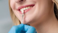 Chất liệu miếng dán răng sứ an toàn cho người sử dụng